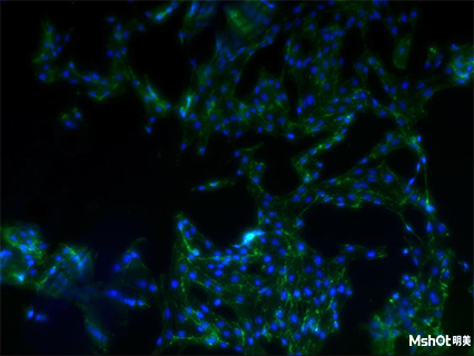 明美熒光顯微鏡應(yīng)用于細(xì)胞爬片觀察