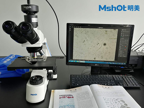 不同顯微鏡用于淀粉檢測(cè)
